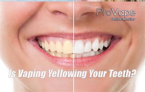 Does vaping discolor teeth  Without sufficient blood flow, the gums do not get the oxygen and nutrients they need to stay healthy